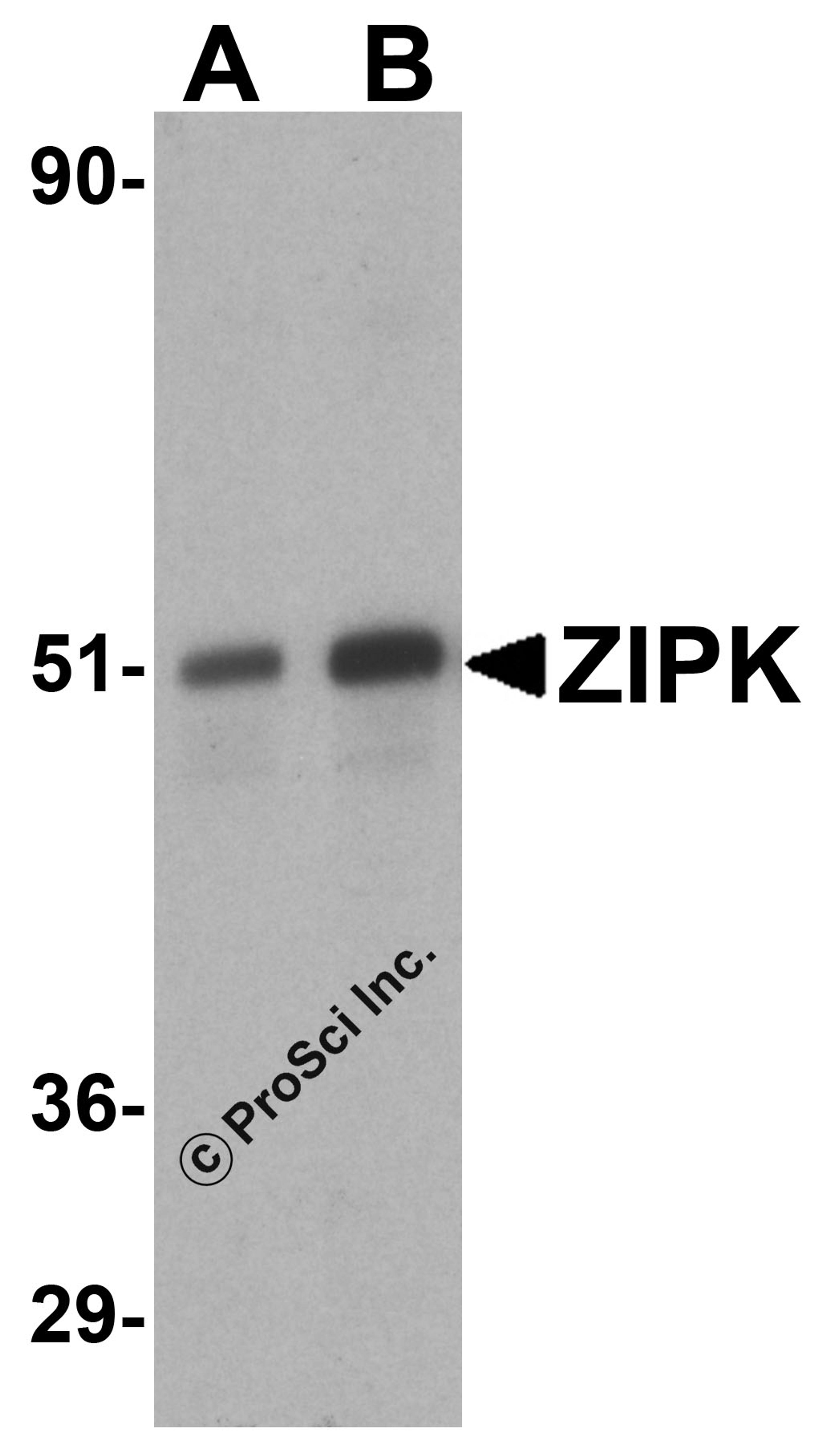 Western blot analysis of ZIP kinase in (A) HeLa and (B) Jurkat lysates with ZIP kinase antibody at 1 μg/mL.
