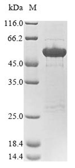 (Tris-Glycine gel) Discontinuous SDS-PAGE (reduced) with 5% enrichment gel and 15% separation gel.