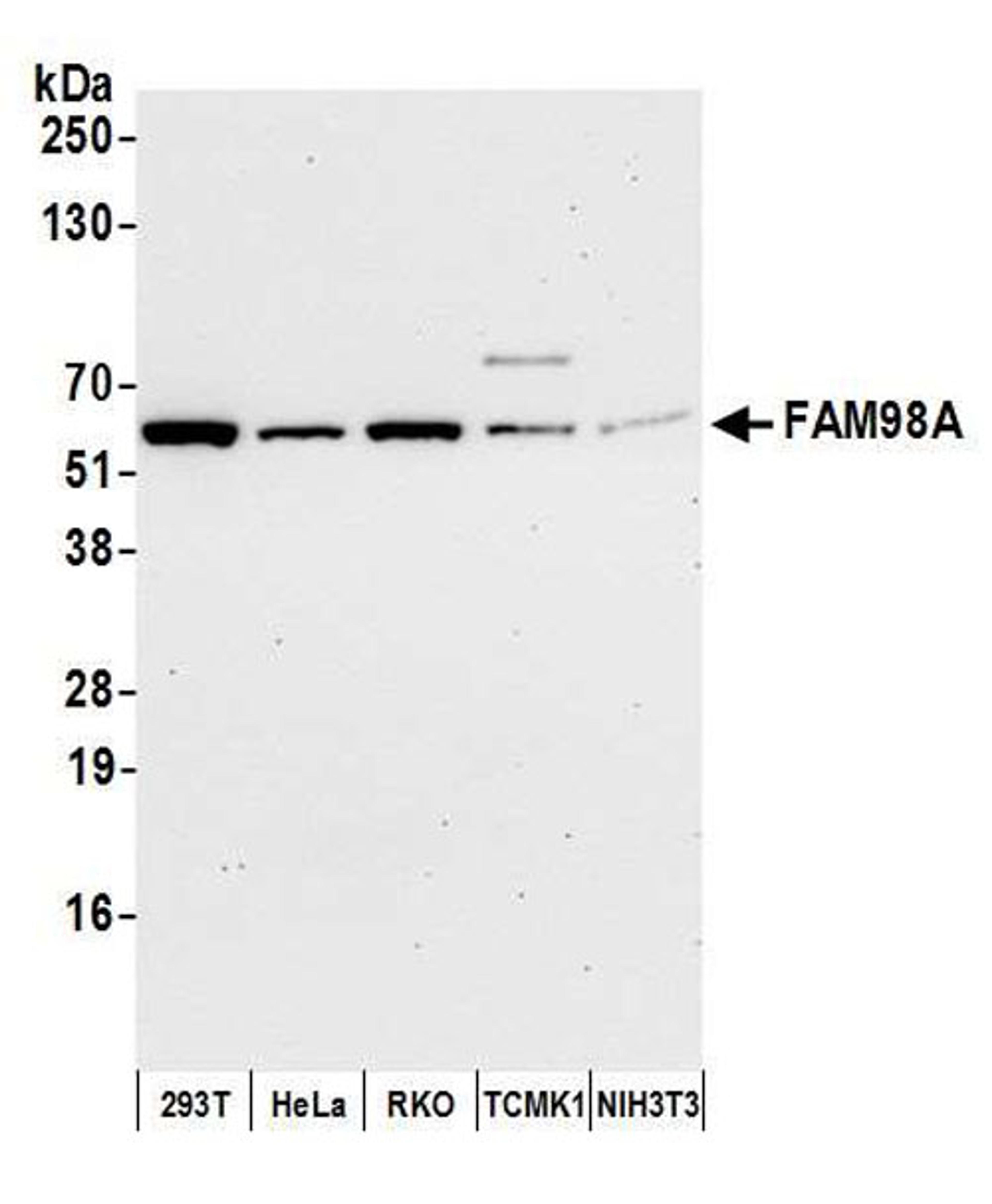 Detection of human and mouse FAM98A by WB.