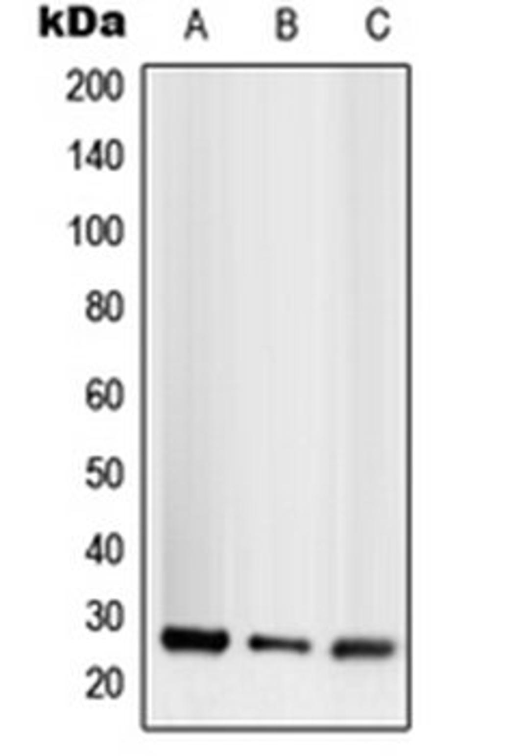 Western blot analysis of HEK293T (Lane 1), SP2/0 (Lane 2), H9C2 (Lane 3) whole cell lysates using TNFSF13 antibody