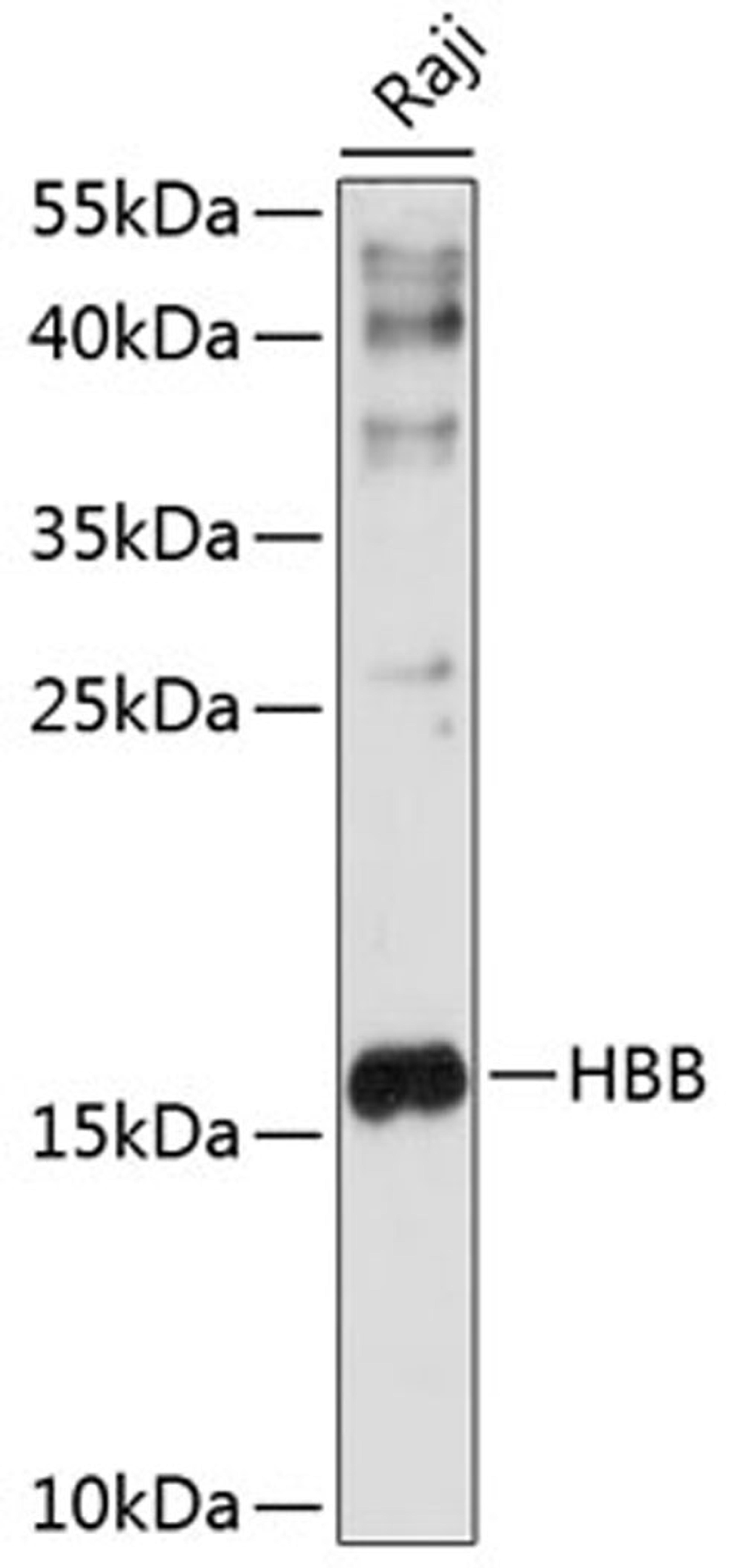 Western blot - HBB antibody (A1331)