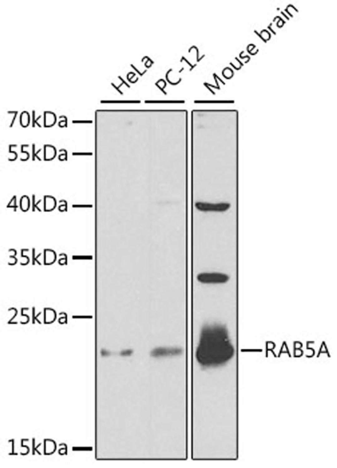 Western blot - RAB5A antibody (A1180)