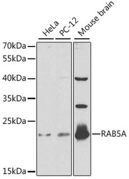 Western blot - RAB5A antibody (A1180)