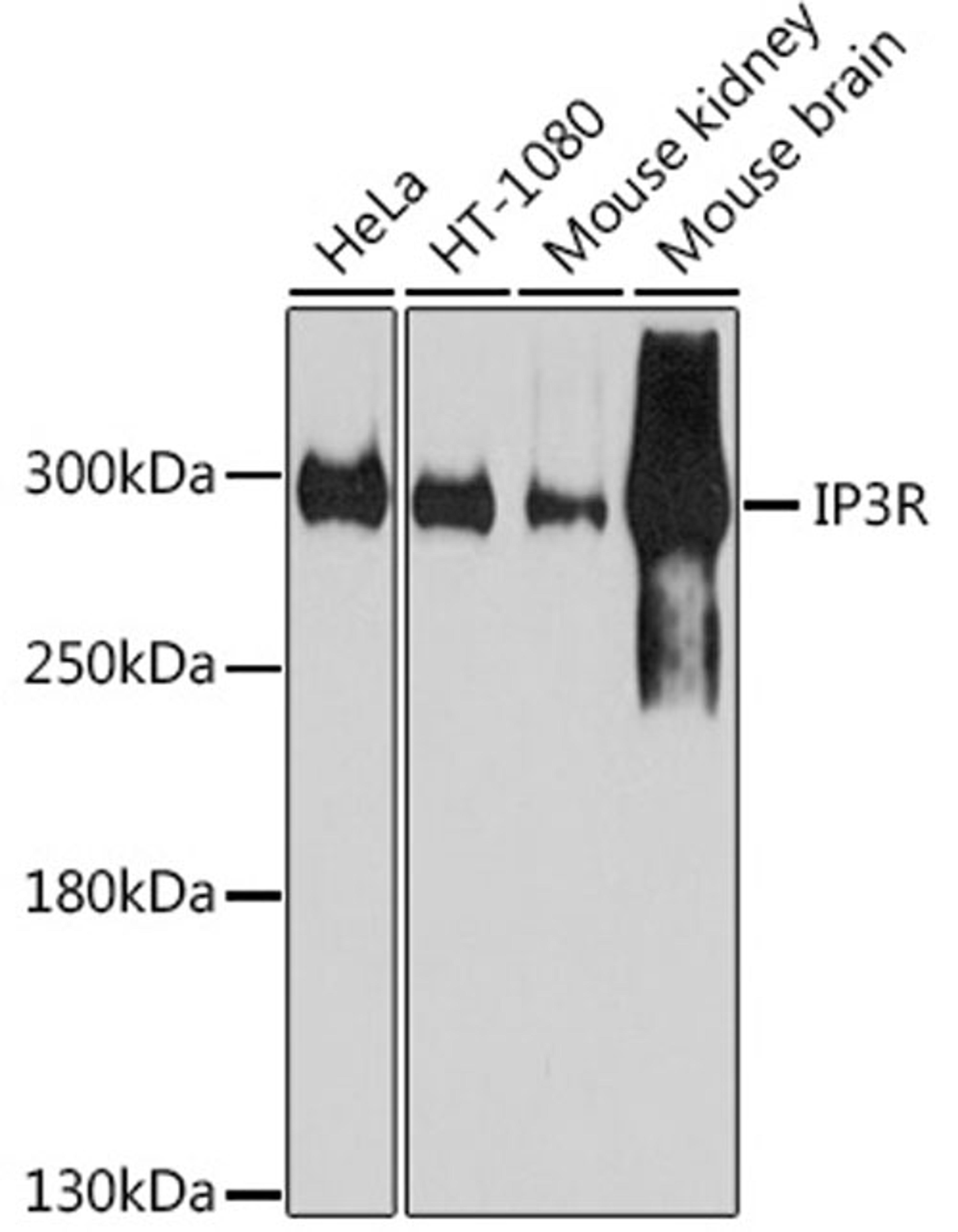 Western blot - IP3R antibody (A7905)