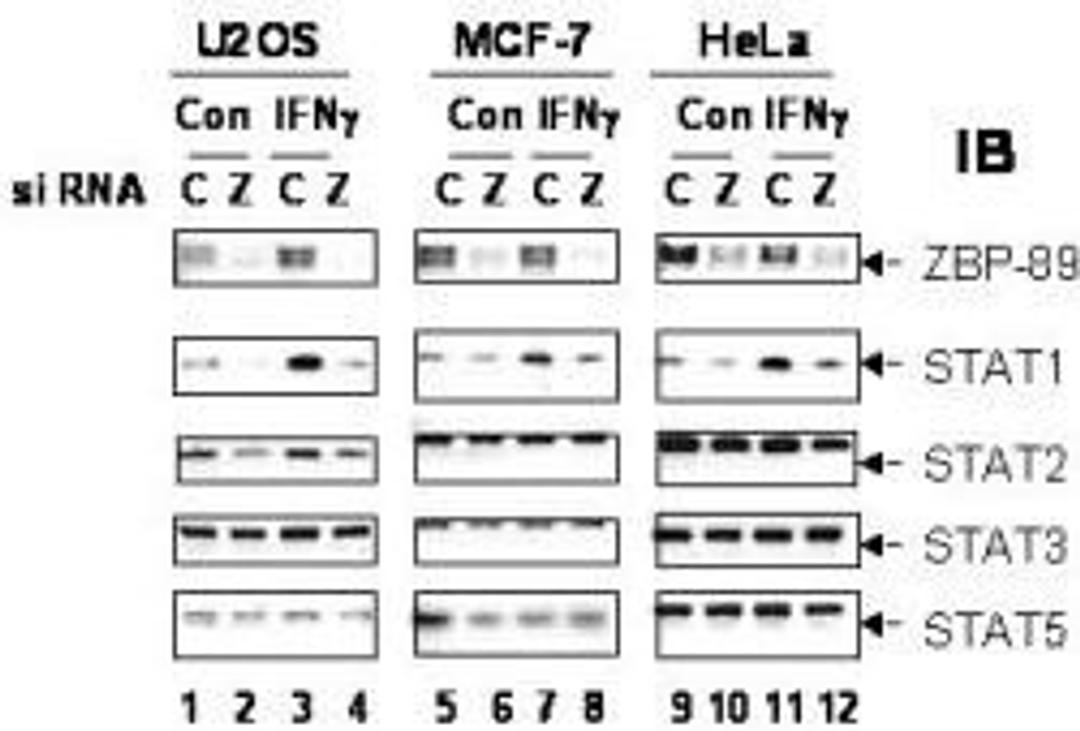 Western blot analysis of confirm siRNA knockdown of ZBP-89 using ZBP-89 antibody