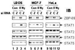 Western blot analysis of confirm siRNA knockdown of ZBP-89 using ZBP-89 antibody