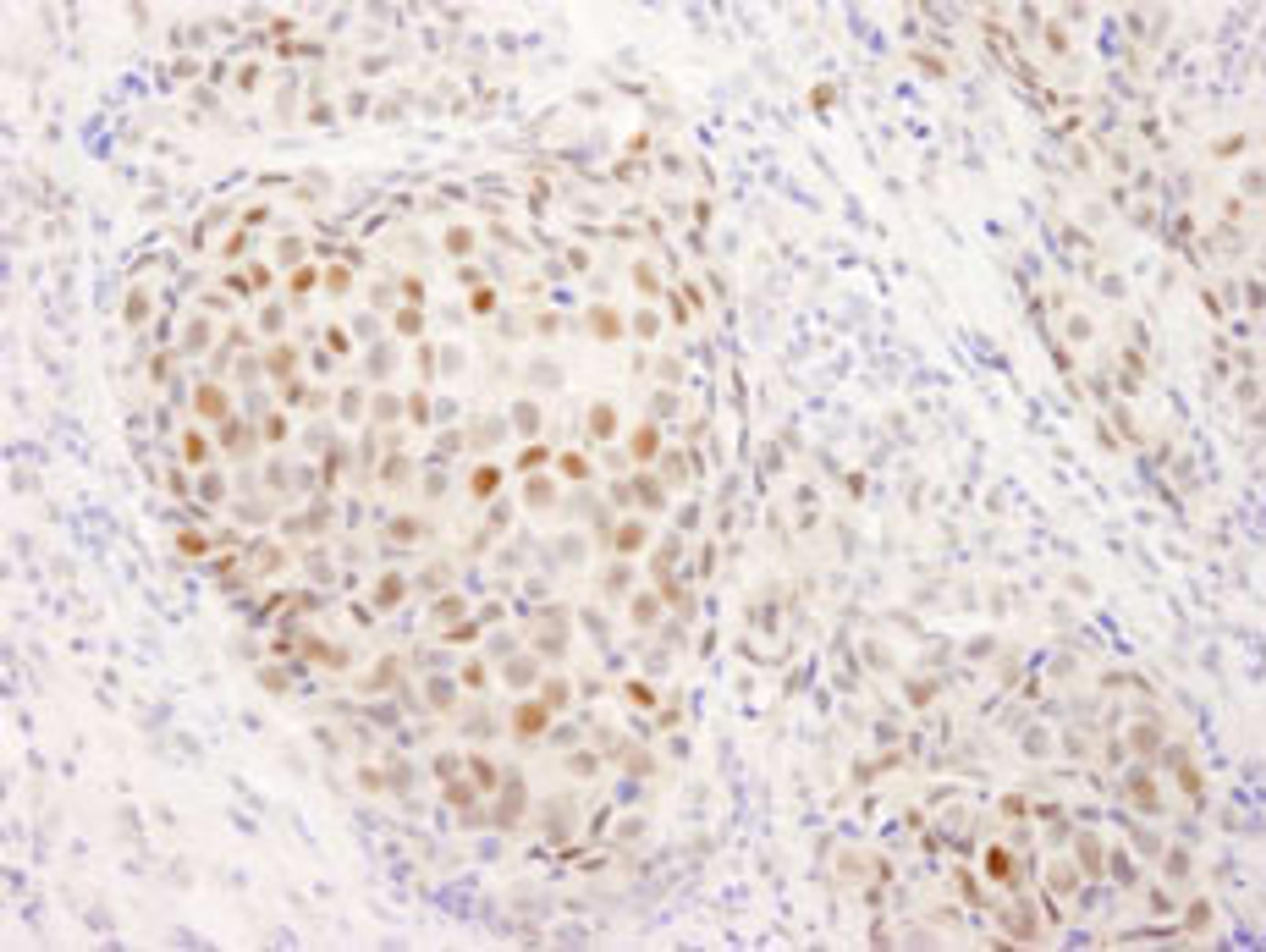 Detection of human Estrogen Receptor alpha by immunohistochemistry.