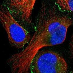 Immunocytochemistry/Immunofluorescence: Tight Junction Protein 1 Antibody [NBP1-85046] - Staining of human cell line U-2 OS shows positivity in cytoplasm & cell junctions.