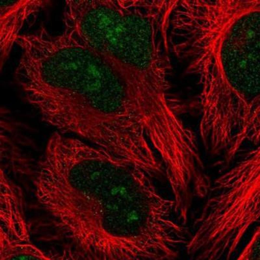 Immunocytochemistry/Immunofluorescence: PRRX1 Antibody [NBP2-13816] - Staining of human cell line HeLa shows positivity in nucleus and nucleoli.