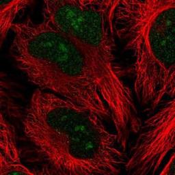 Immunocytochemistry/Immunofluorescence: PRRX1 Antibody [NBP2-13816] - Staining of human cell line HeLa shows positivity in nucleus and nucleoli.