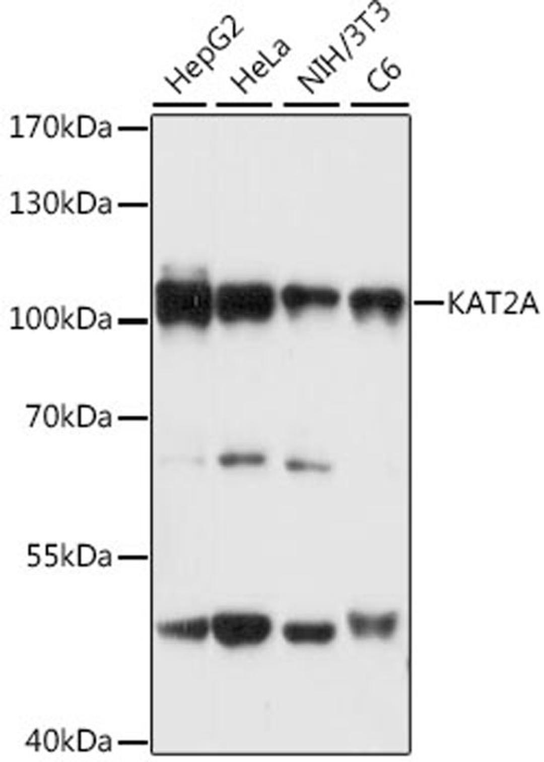 Western blot - KAT2A antibody (A2224)