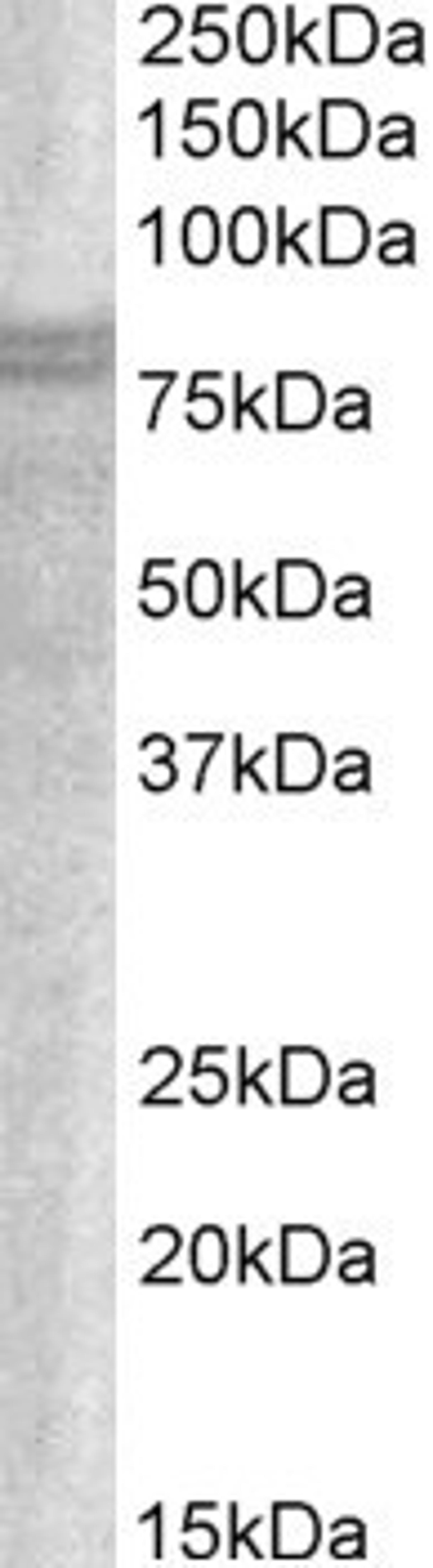 46-401 (1ug/ml) staining of A549 lysate (35ug protein in RIPA buffer). Primary incubation was 1 hour. Detected by chemiluminescence.