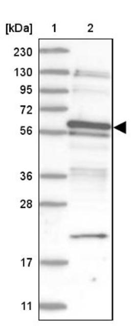 Western Blot: TSPYL1 Antibody [NBP1-86898] - Lane 1: Marker [kDa] 230, 130, 95, 72, 56, 36, 28, 17, 11<br/>Lane 2: Human cell line RT-4