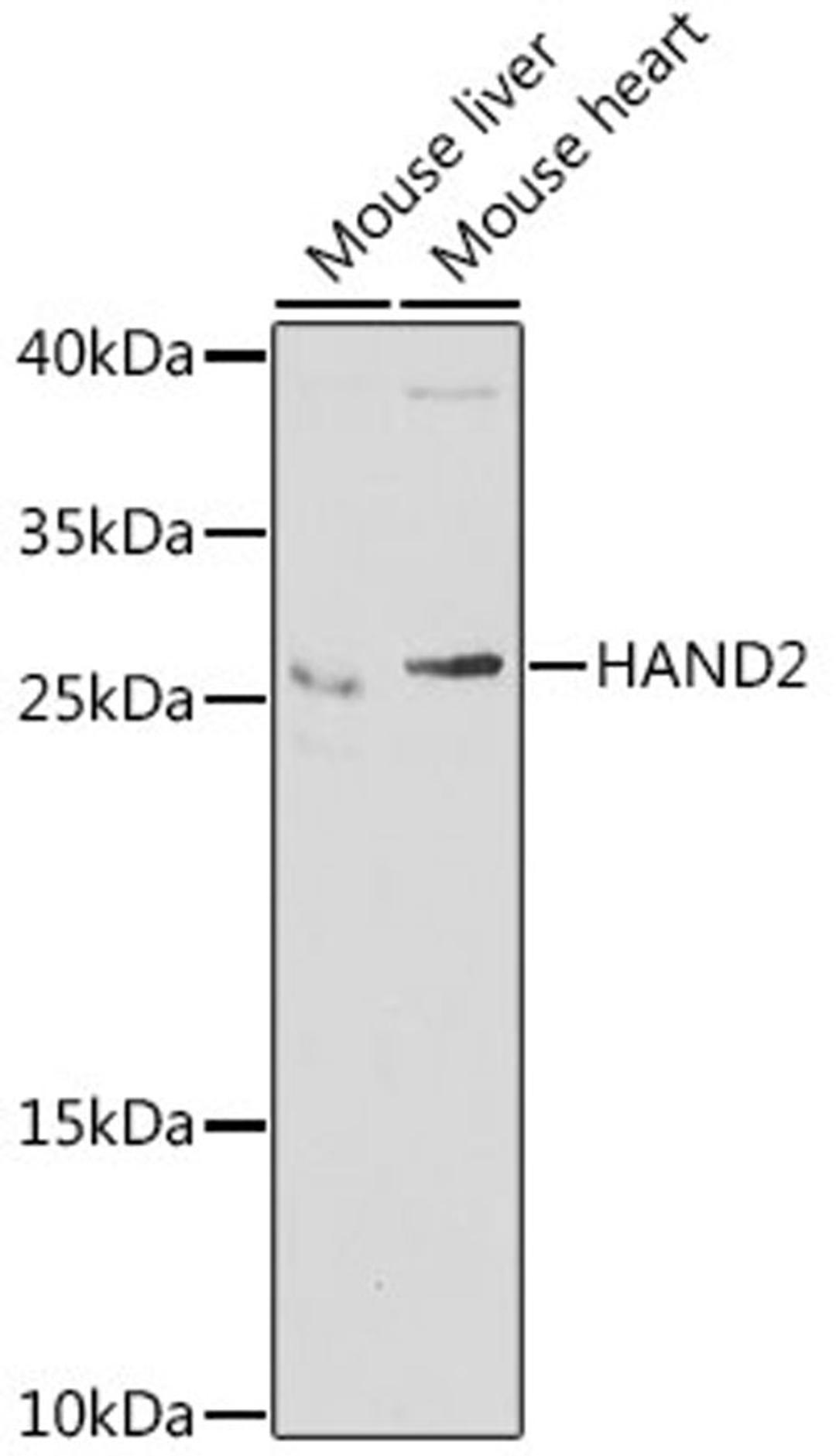 Western blot - HAND2 antibody (A7044)