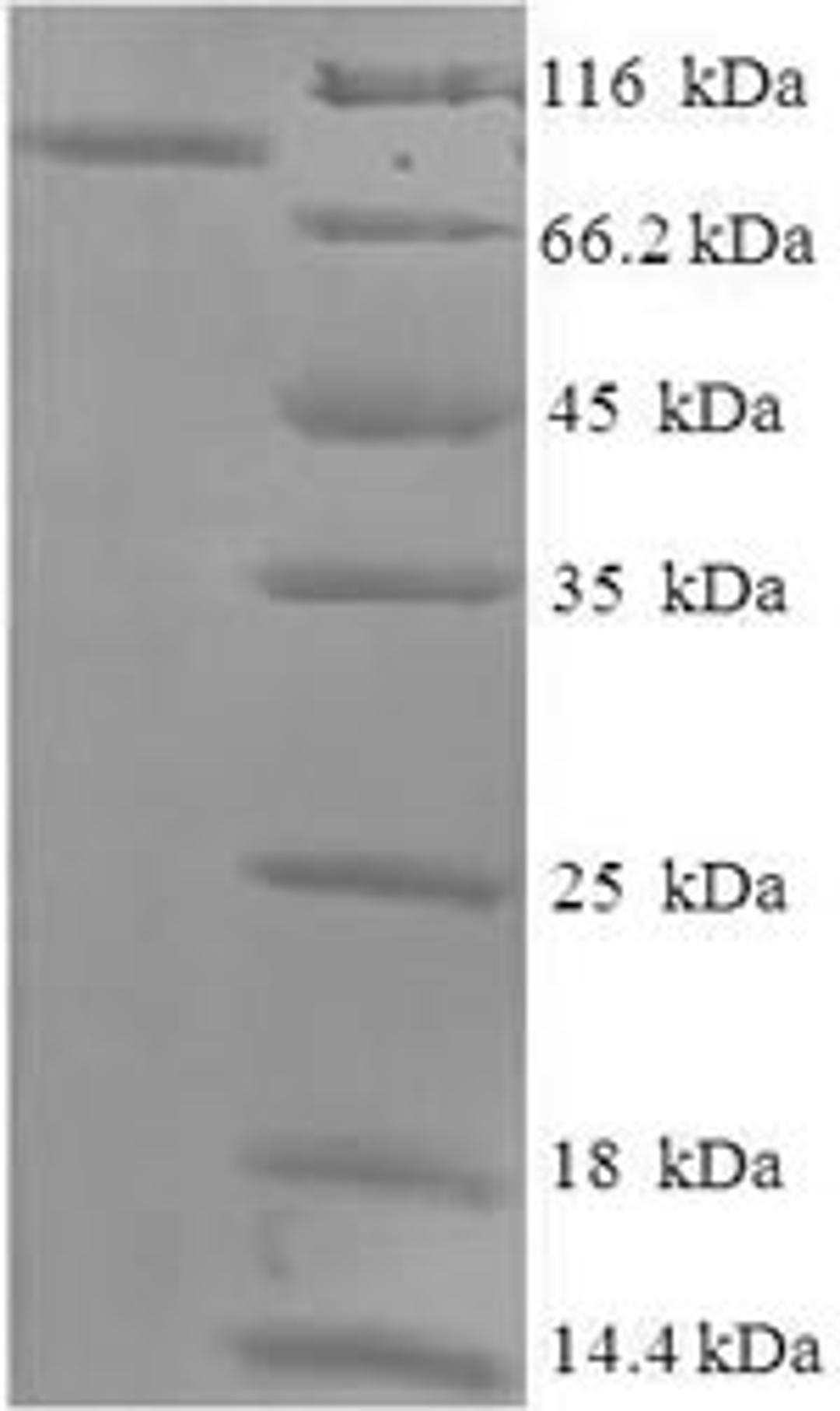 (Tris-Glycine gel) Discontinuous SDS-PAGE (reduced) with 5% enrichment gel and 15% separation gel.