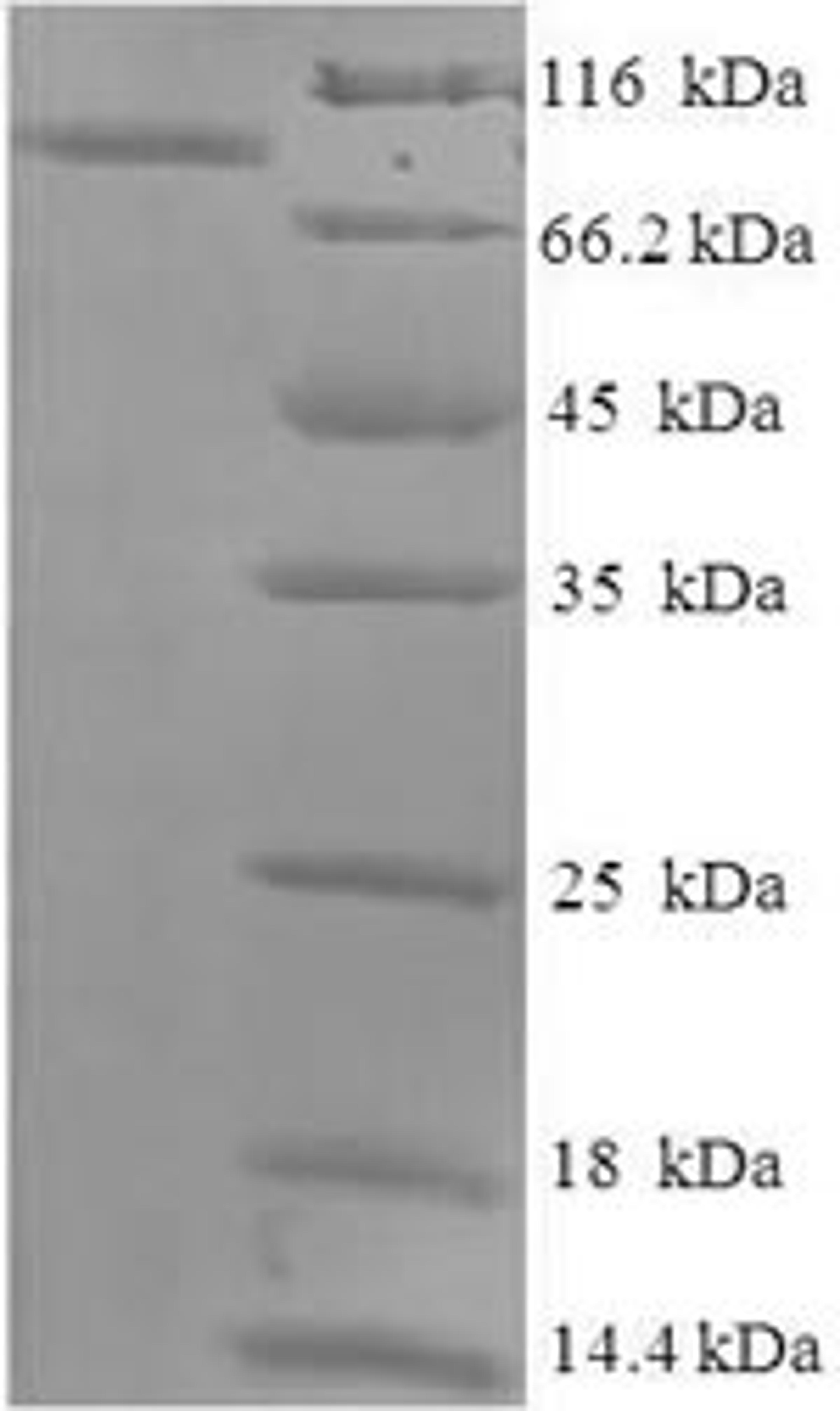 (Tris-Glycine gel) Discontinuous SDS-PAGE (reduced) with 5% enrichment gel and 15% separation gel.