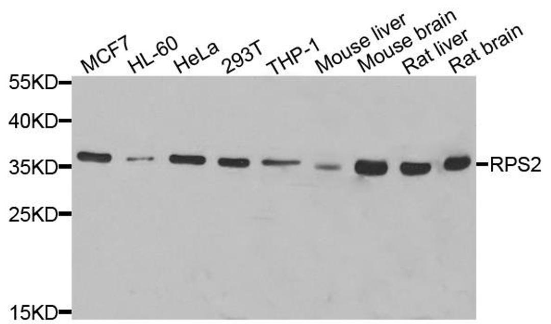 Western blot analysis of extracts of various cell lines using RPS2 antibody