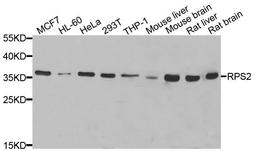 Western blot analysis of extracts of various cell lines using RPS2 antibody