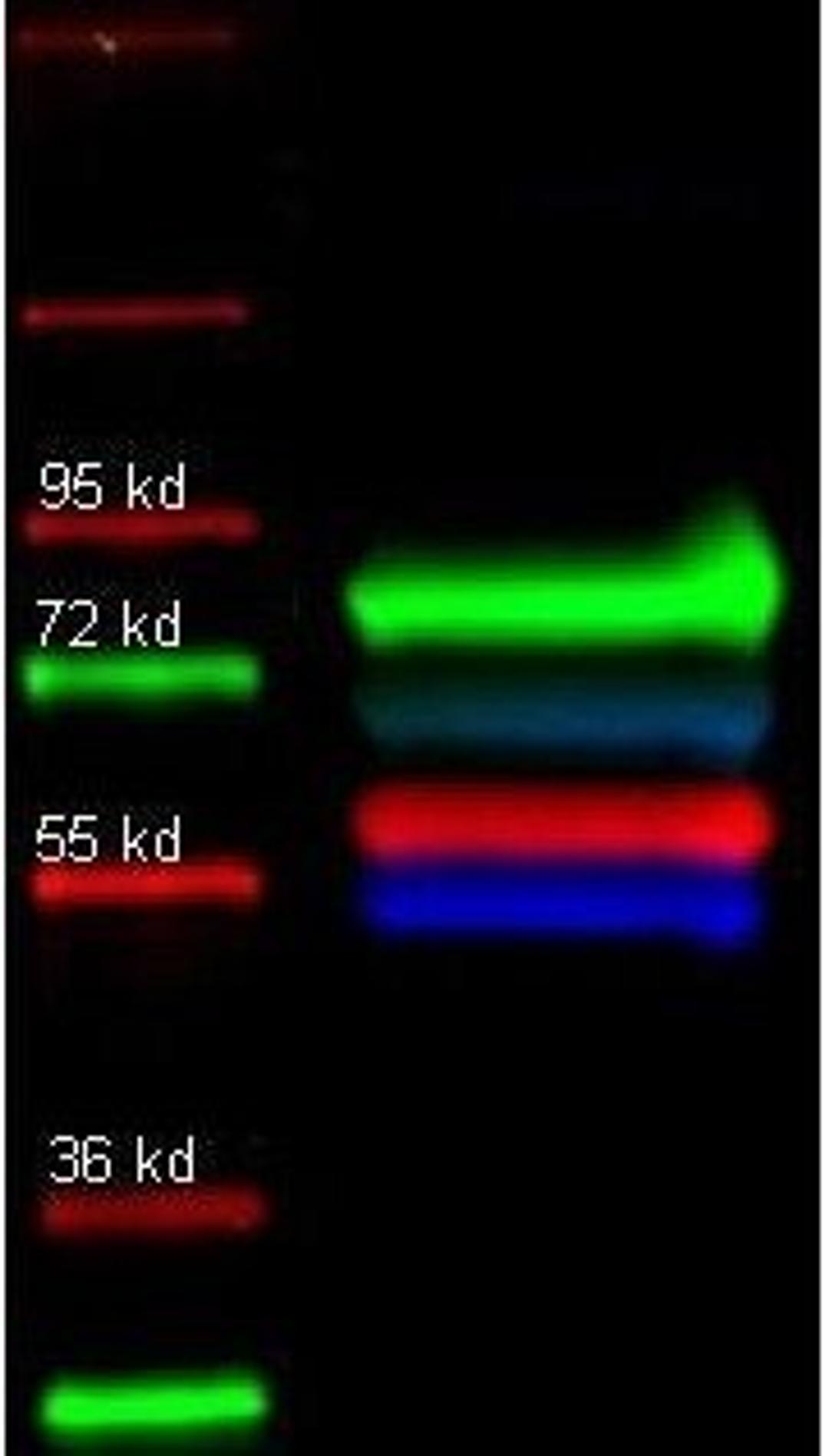 Western blot analysis of Human transferrin tissue using Alpha 1 Trypsin antibody