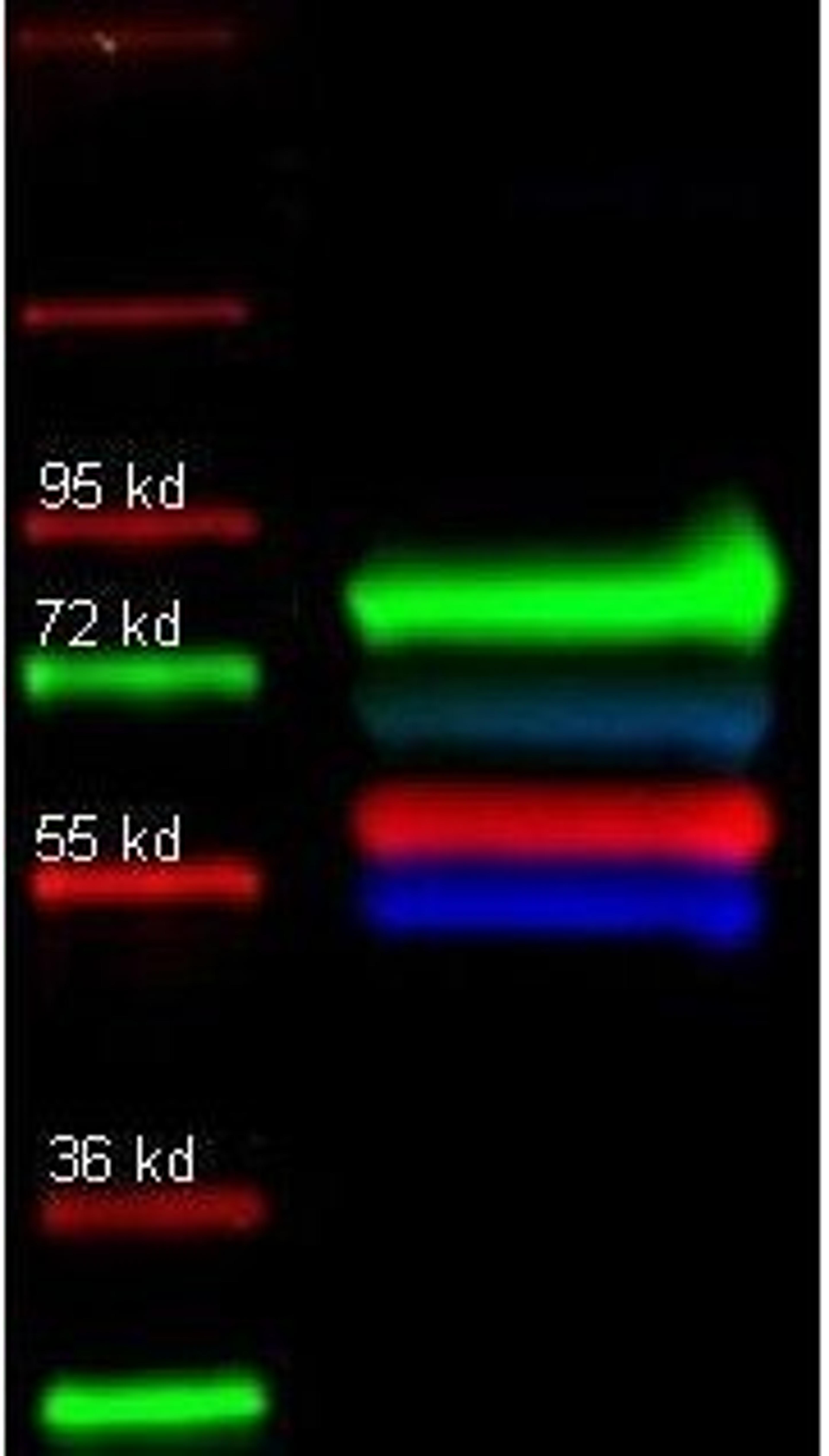 Western blot analysis of Human transferrin tissue using Alpha 1 Trypsin antibody