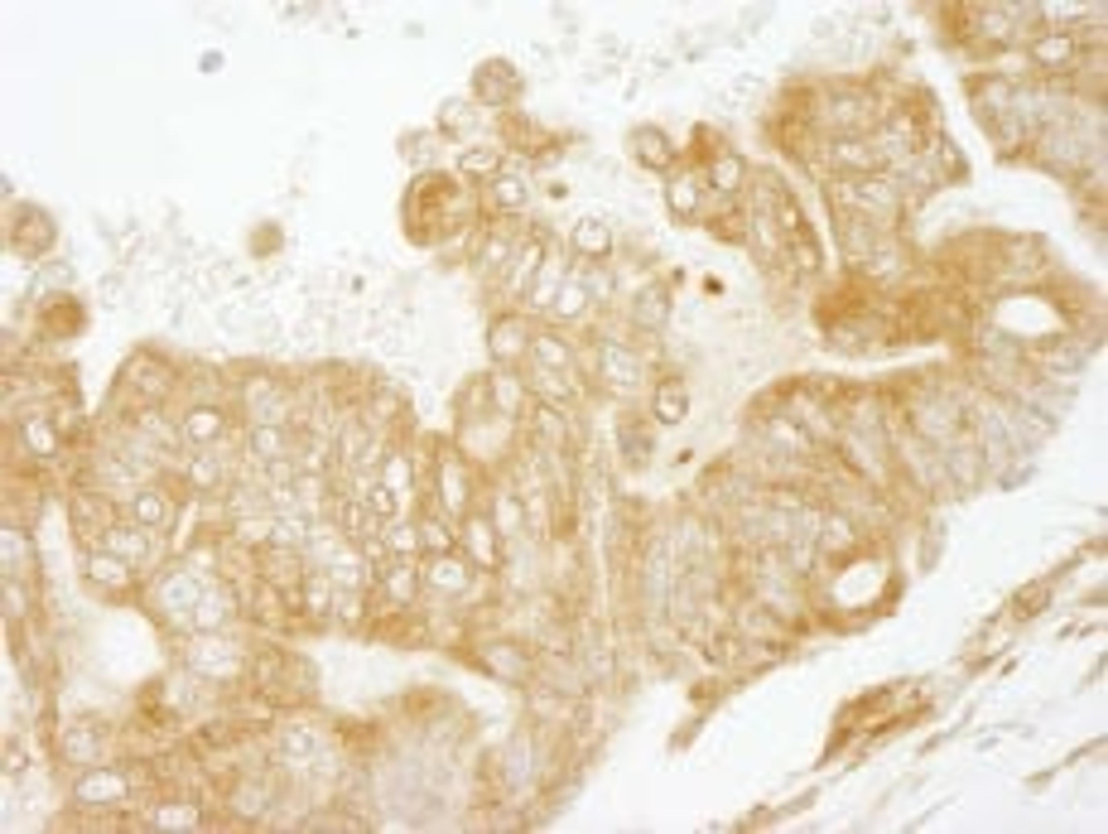 Detection of human EEA1 immunohistochemistry.