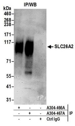 Detection of human SLC26A2 by western blot of immunoprecipitates.