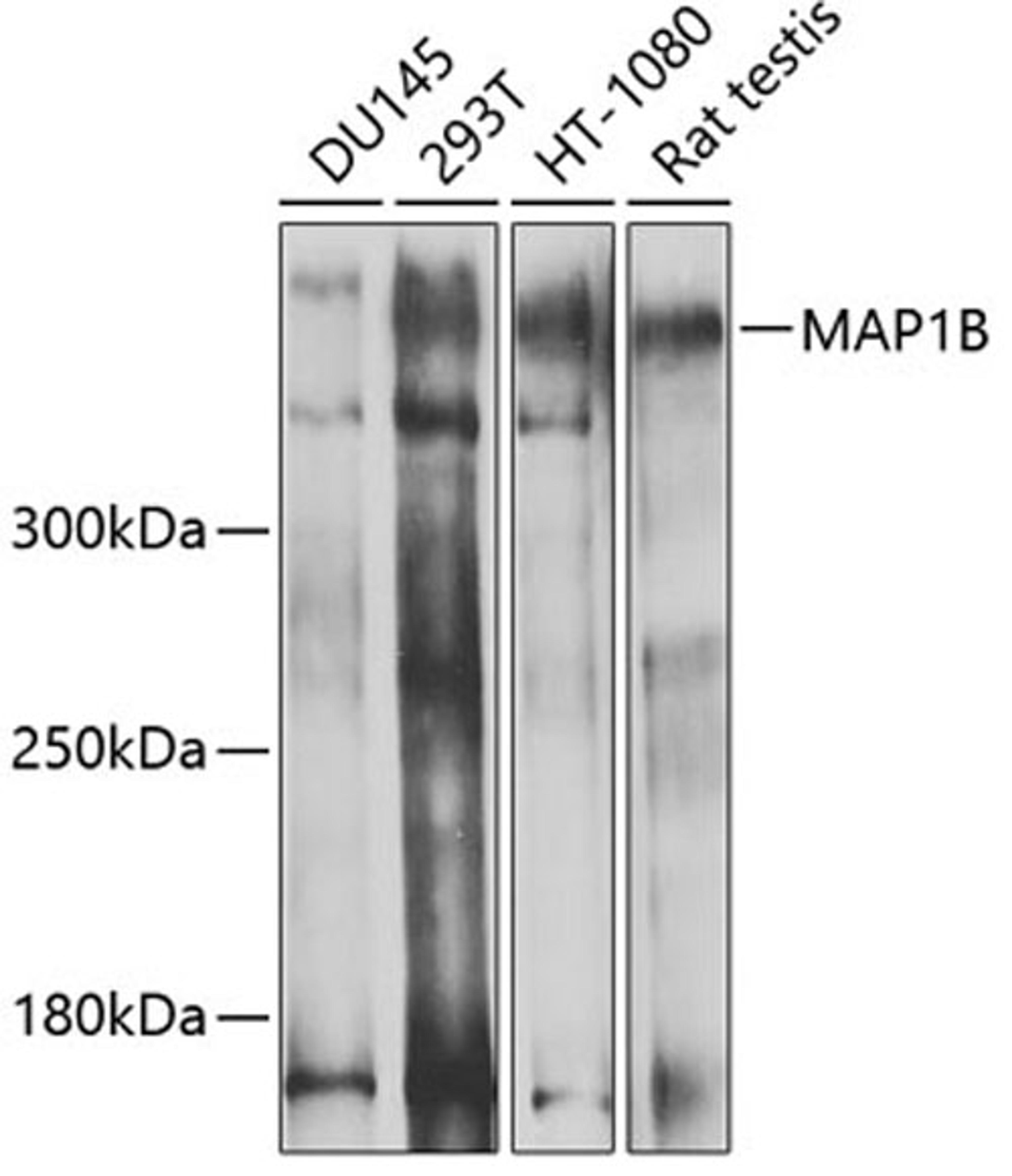 Western blot - MAP1B antibody (A3305)