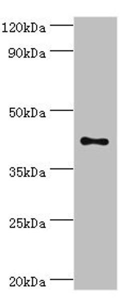 Western blot. All lanes: Transcription factor Dp-1 antibody at 2ug/ml + HepG2 whole cell lysate. Secondary. Goat polyclonal to rabbit IgG at 1/10000 dilution. Predicted band size: 46, 35 kDa. Observed band size: 46 kDa. 