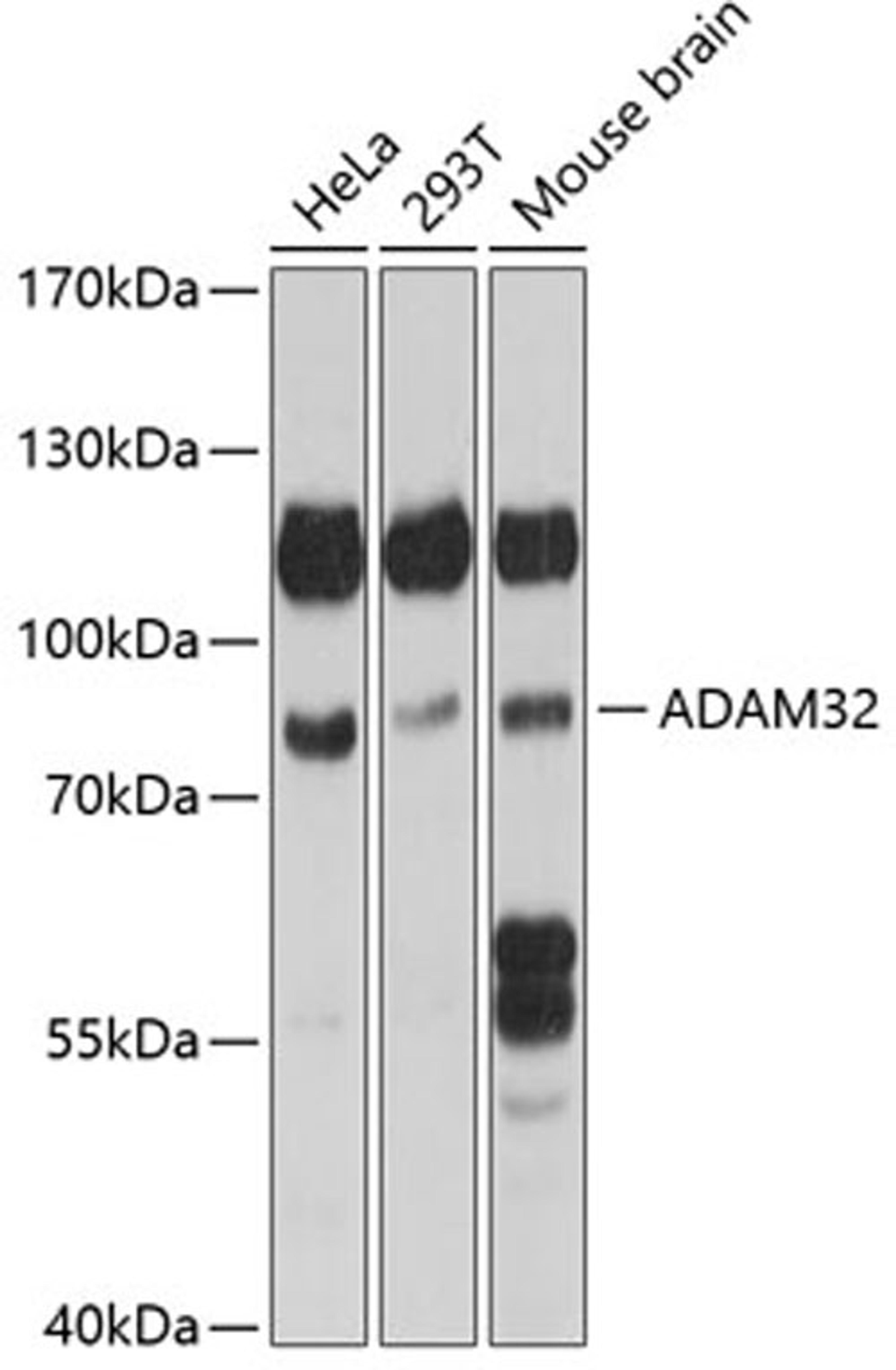 Western blot - ADAM32 antibody (A14977)