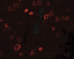 Immunofluorescence: TPT1/TCTP Antibody [NBP2-41206] - TPT1 in rat brain tissue with TPT1 antibody at 20 ug/ml.