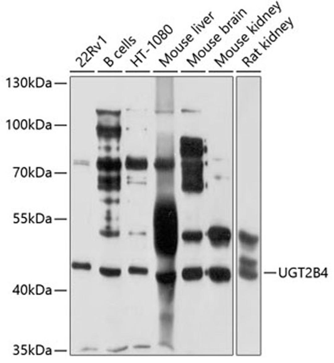 Western blot - UGT2B4 antibody (A4180)