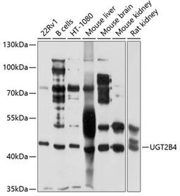 Western blot - UGT2B4 antibody (A4180)