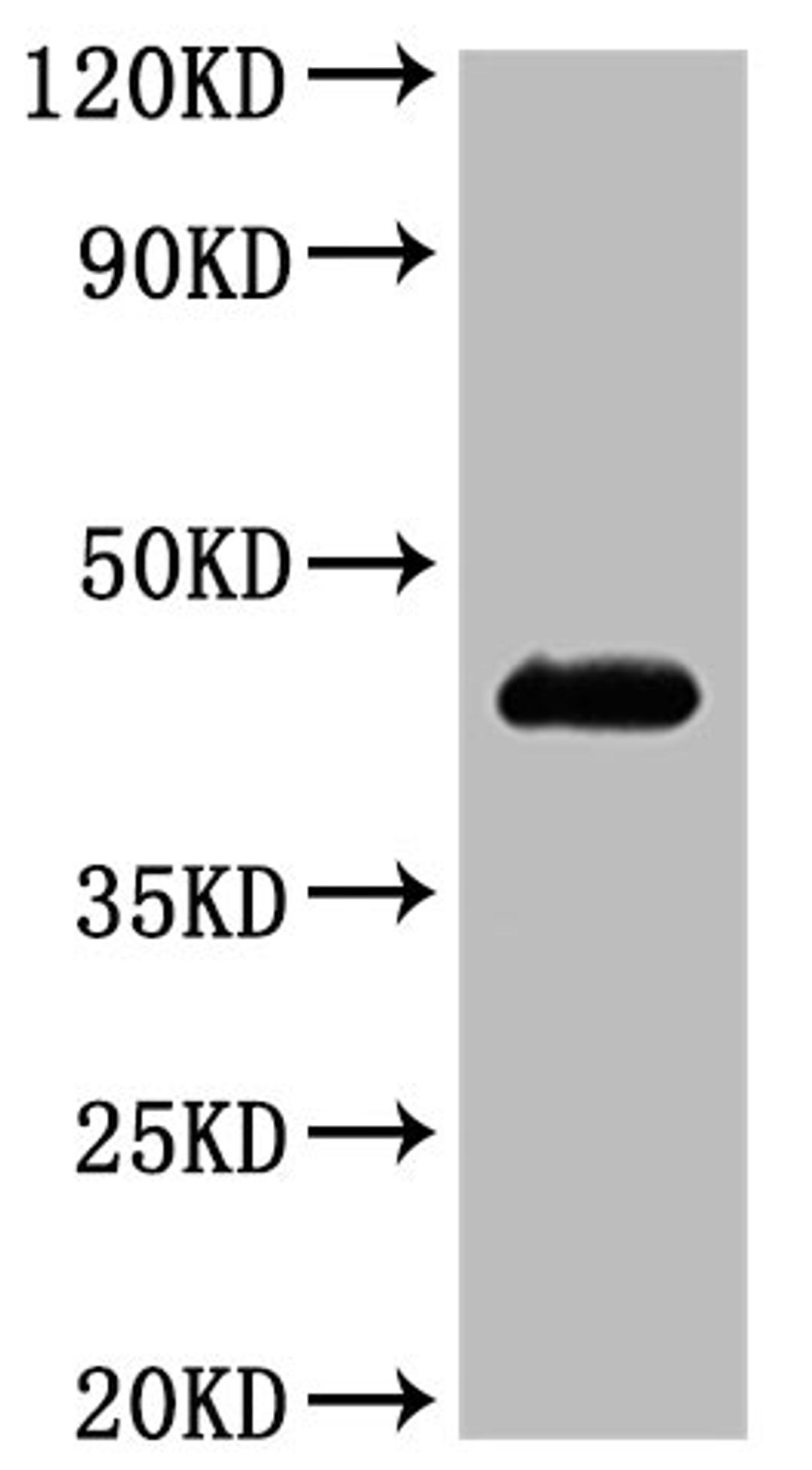 CSB-MP004843HU is detected by Mouse anti-6*His monoclonal antibody.