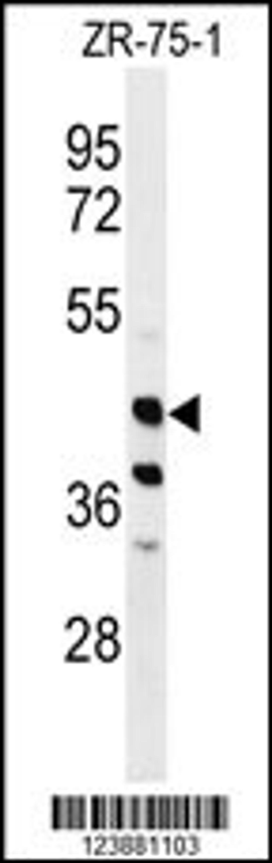 Western blot analysis of FA2H Antibody in ZR-75-1 cell line lysates (35ug/lane)