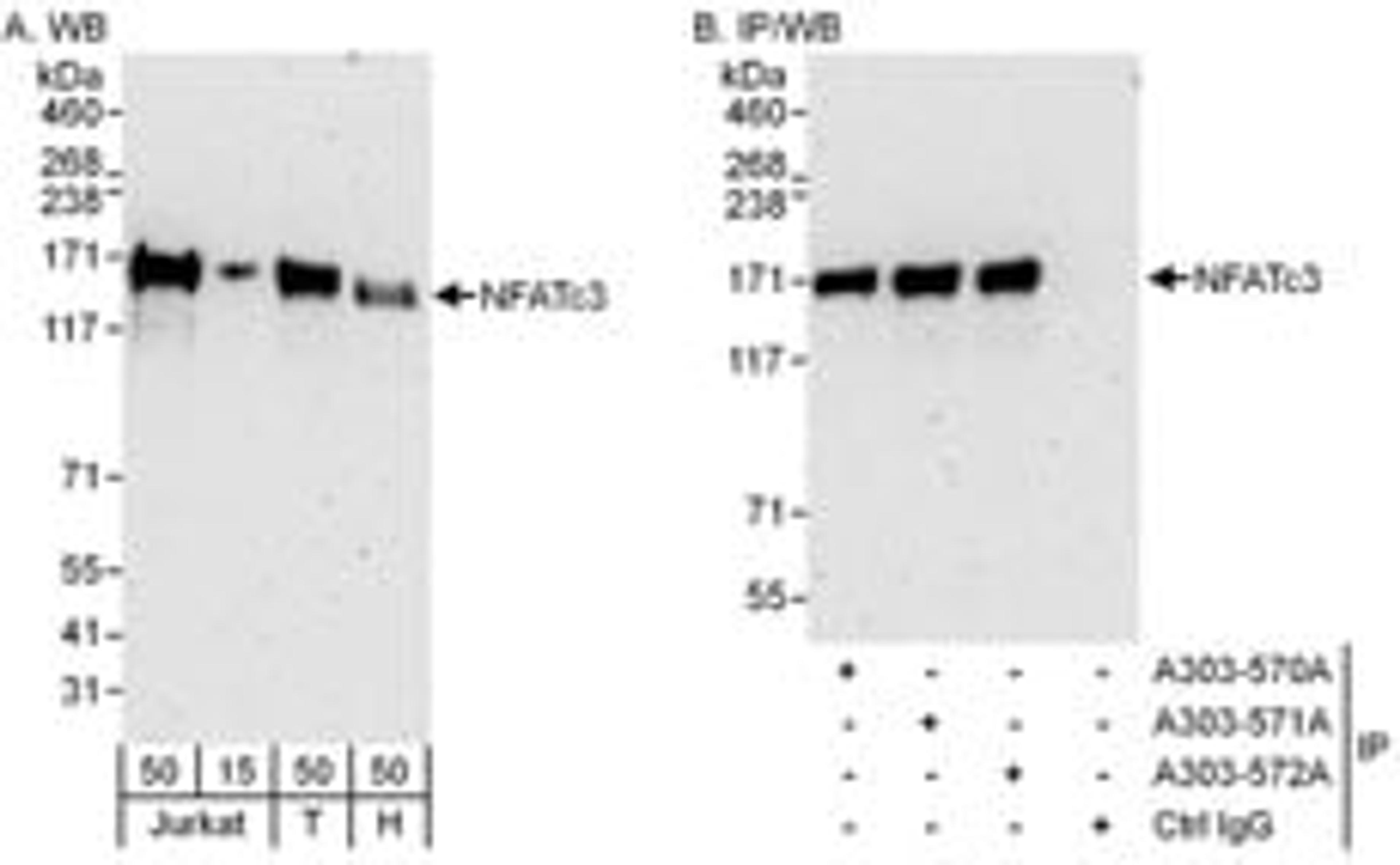 Detection of human NFATc3 by western blot and immunoprecipitation.