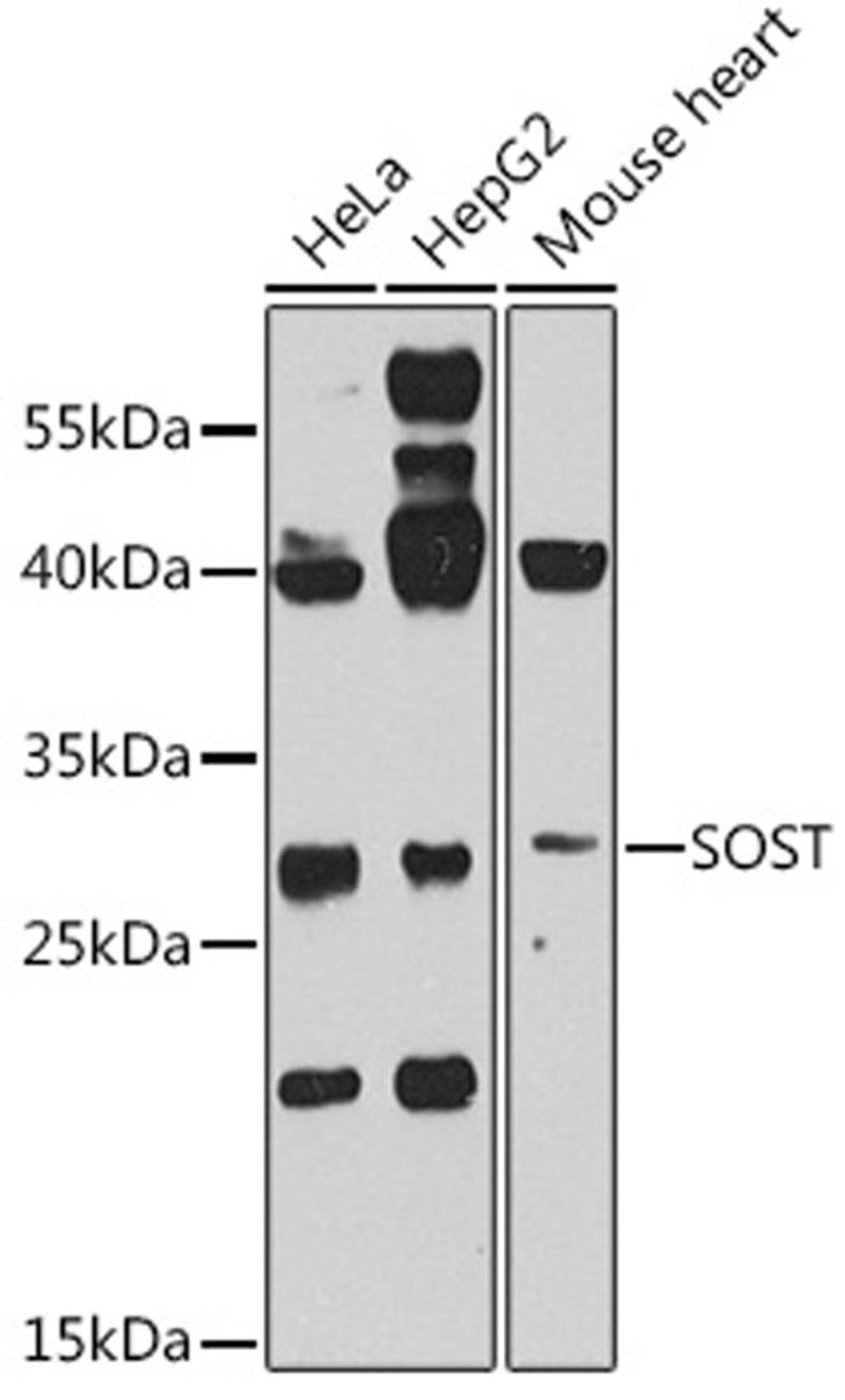 Western blot - SOST antibody (A8213)