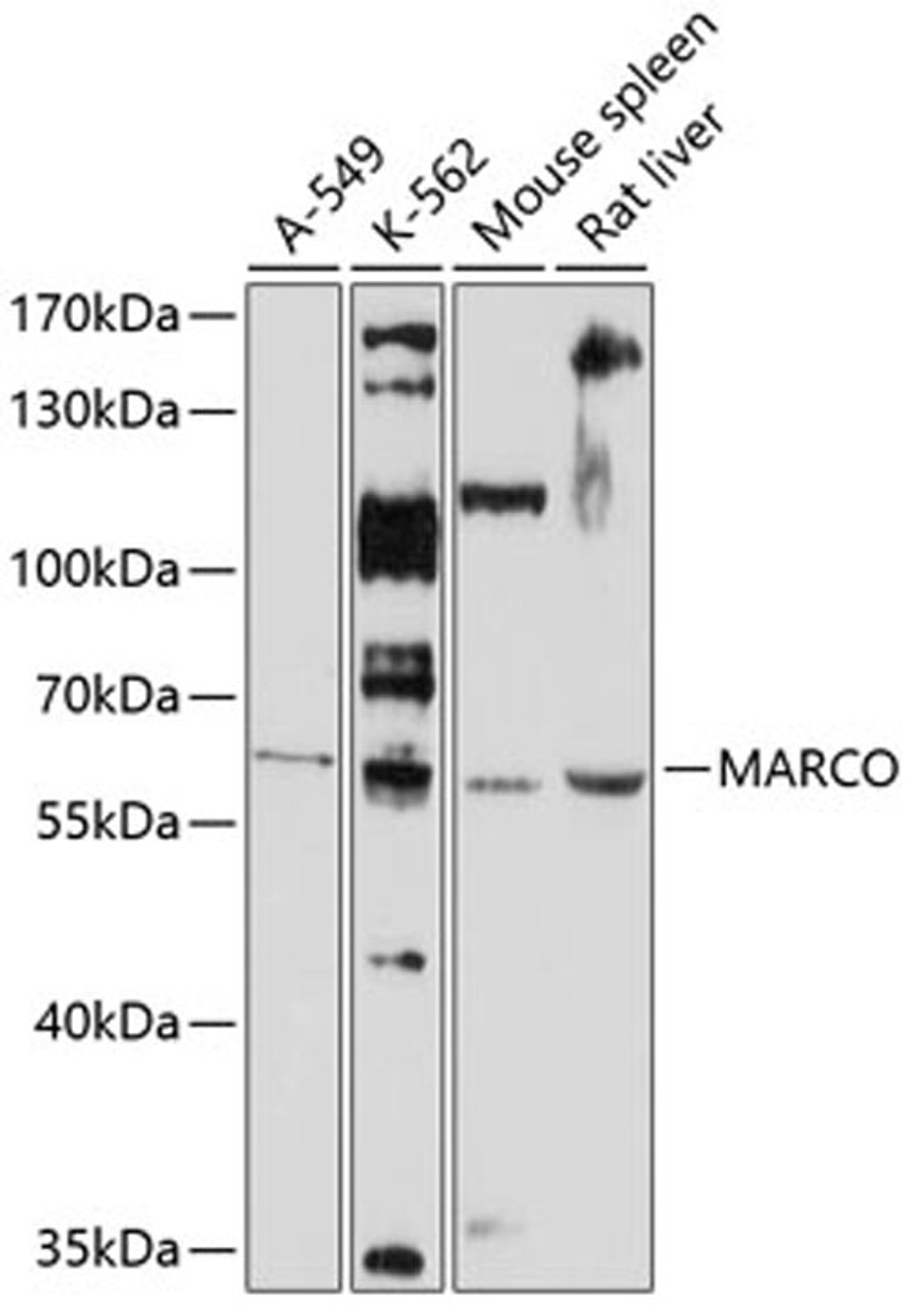 Western blot - MARCO antibody (A10048)