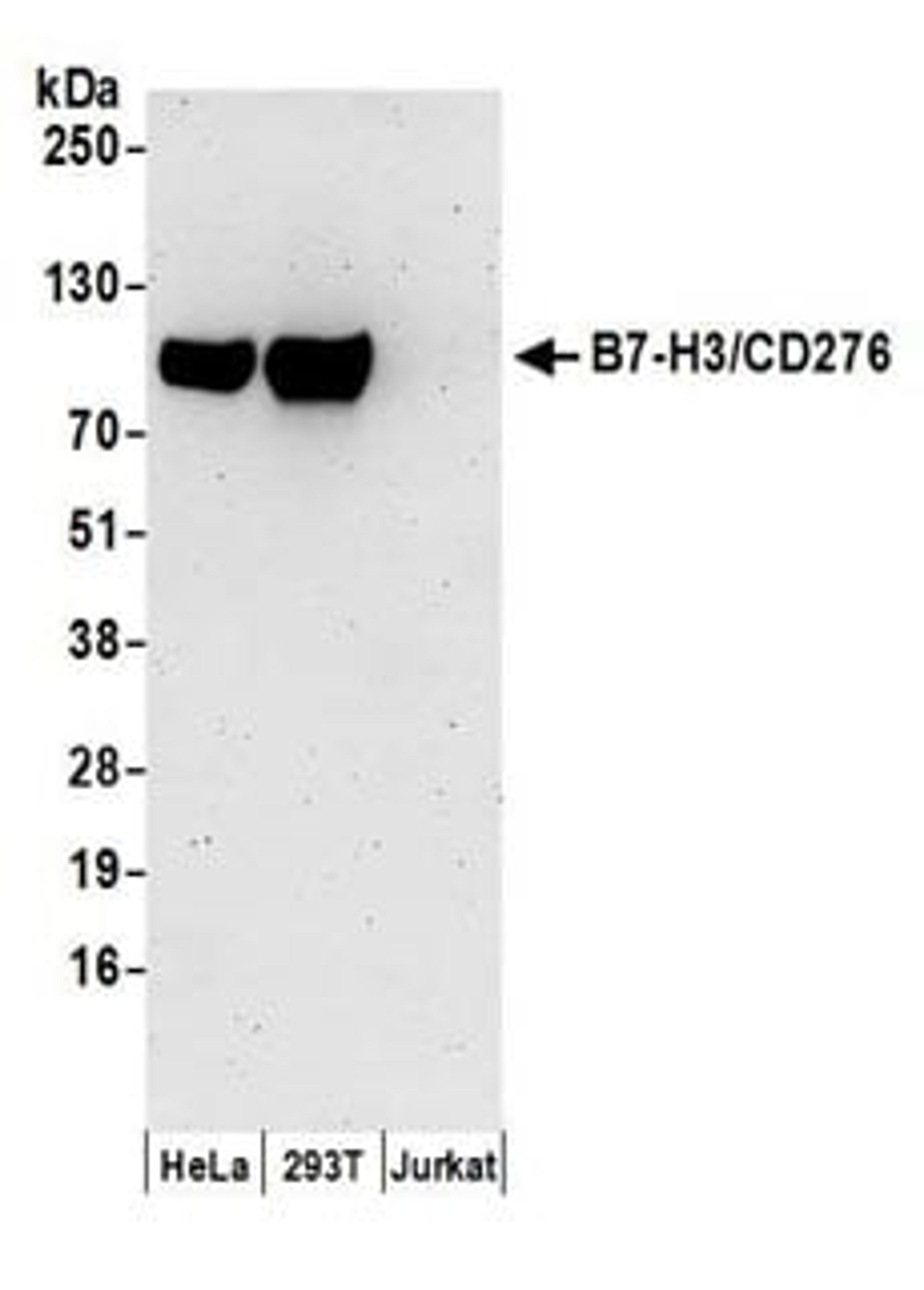 Detection of human B7-H3/CD276 by western blot.