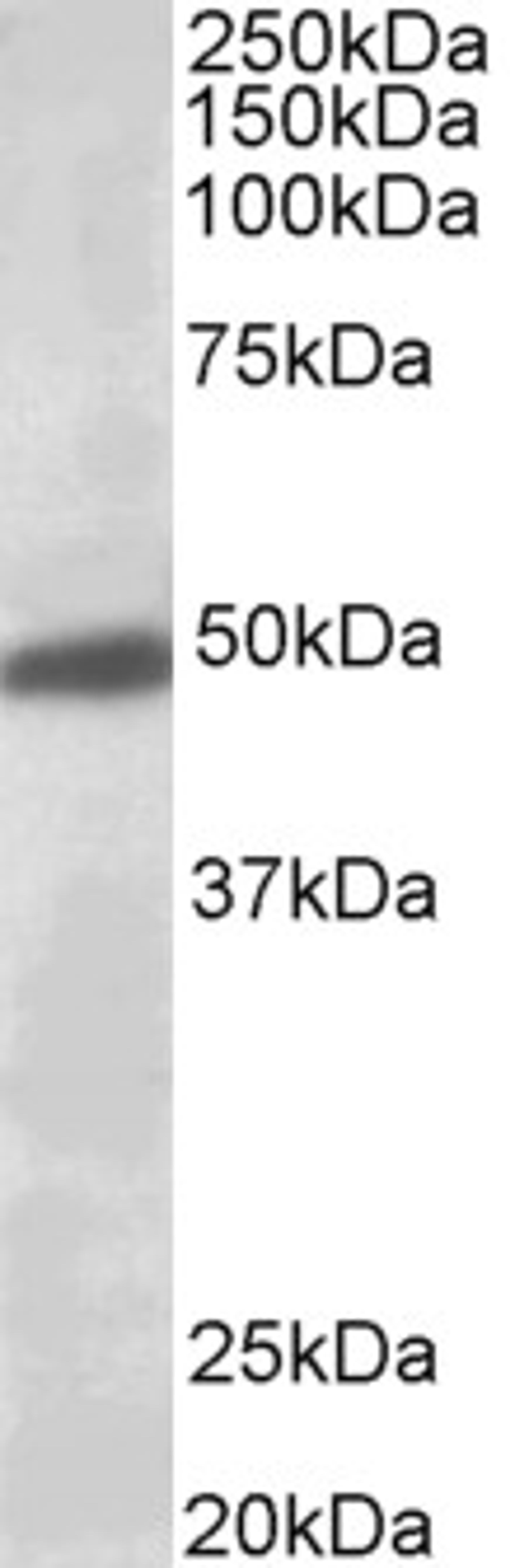 45-672 (0.5ug/ml) staining of Human Brain (Substantia Nigra) lysate (35ug protein in RIPA buffer). Primary incubation was 1 hour. Detected by chemiluminescence.