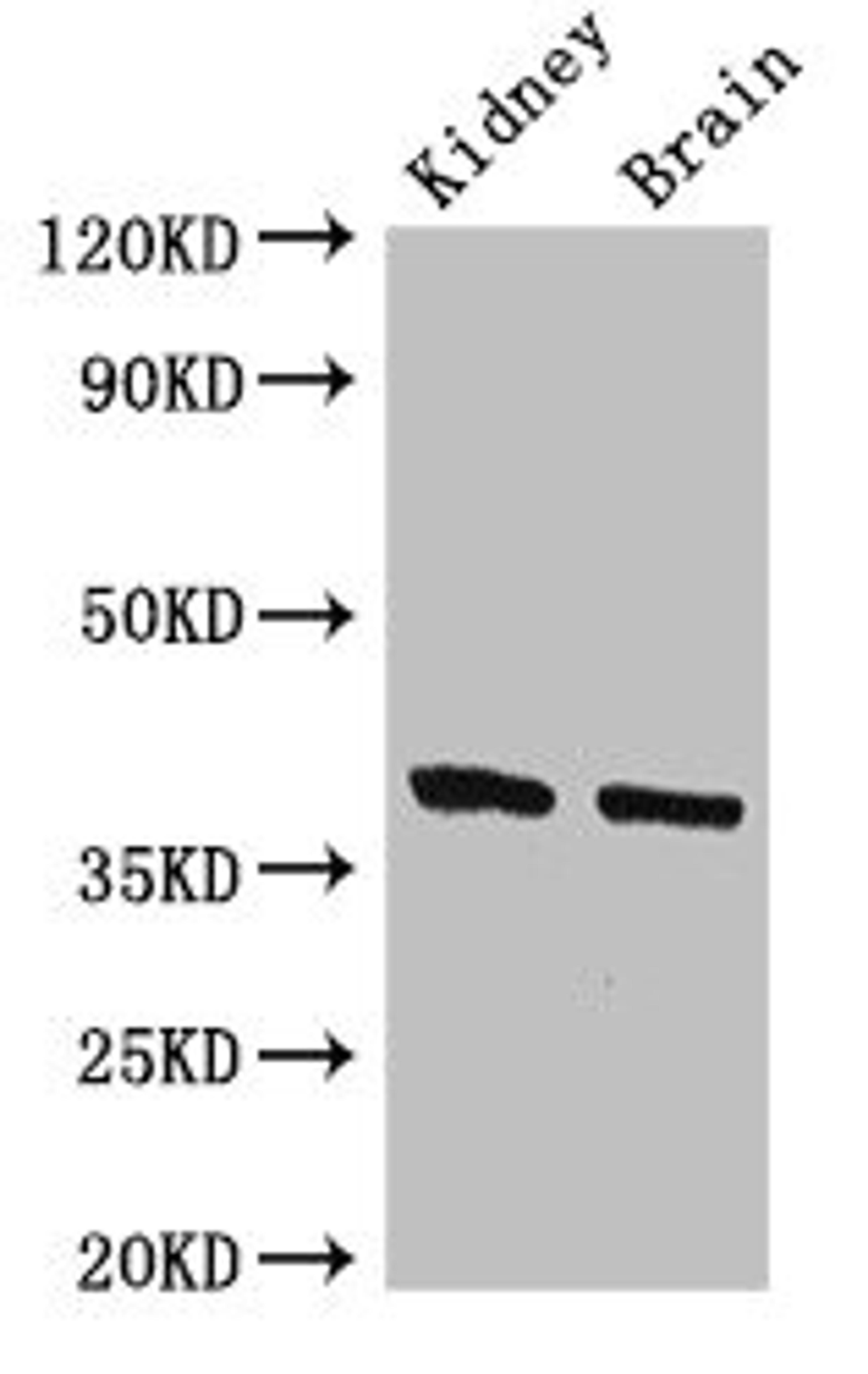 Western Blot. Positive WB detected in: Mouse kidney tissue, Mouse brain tissue. All lanes: FOXE1 antibody at 2.4ug/ml. Secondary. Goat polyclonal to rabbit IgG at 1/50000 dilution. Predicted band size: 39 kDa. Observed band size: 39 kDa.