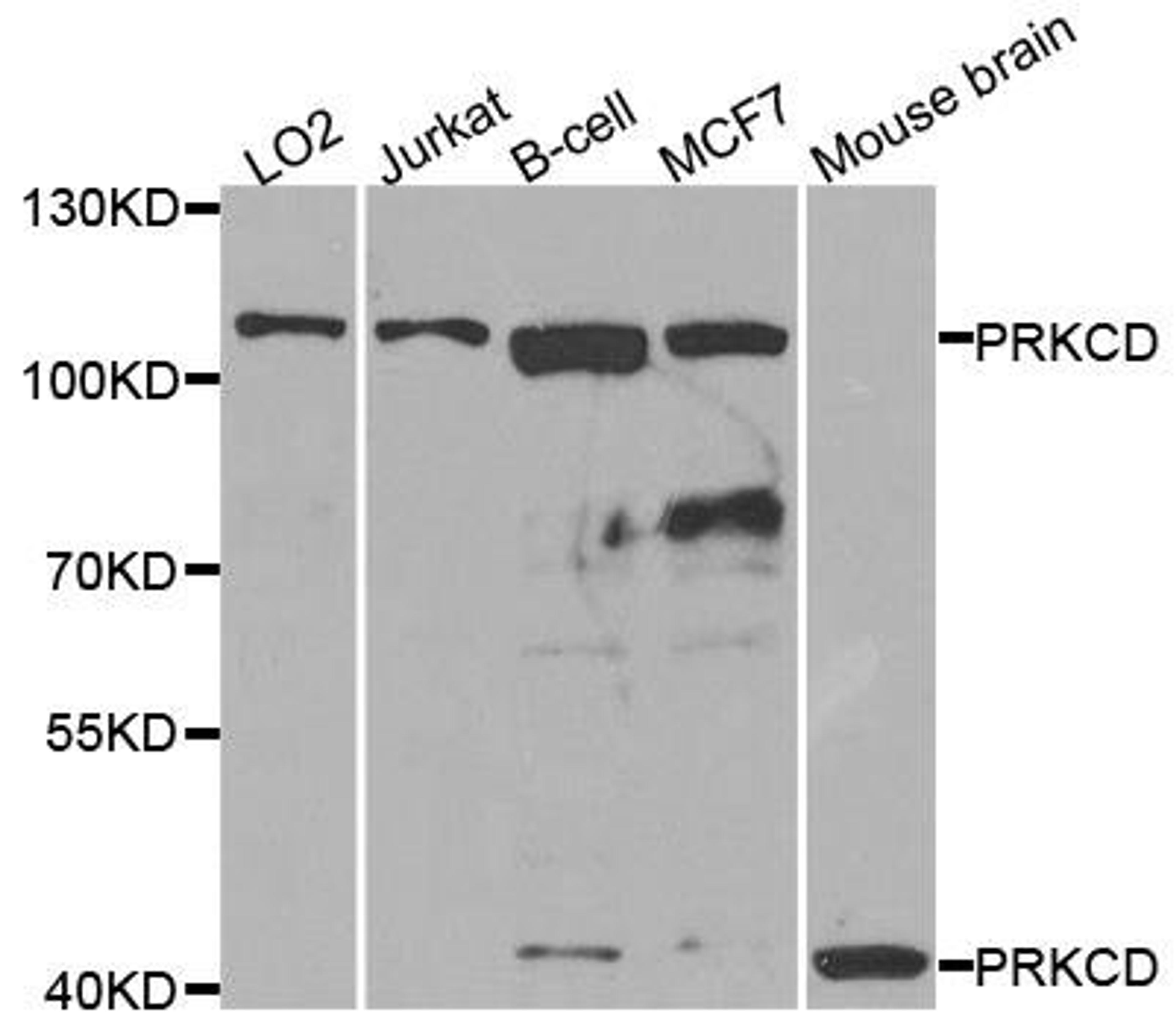 Western blot analysis of extracts of various cell lines using PKCD antibody