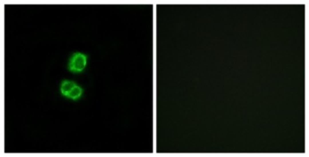 Immunocytochemistry/Immunofluorescence: FGF-22 Antibody [NBP1-68291] - Analysis of MCF7 cells, using FGF-22 Antibody. The picture on the right is treated with the synthesized peptide.