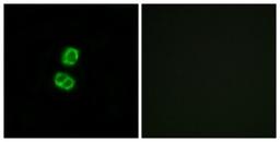 Immunocytochemistry/Immunofluorescence: FGF-22 Antibody [NBP1-68291] - Analysis of MCF7 cells, using FGF-22 Antibody. The picture on the right is treated with the synthesized peptide.