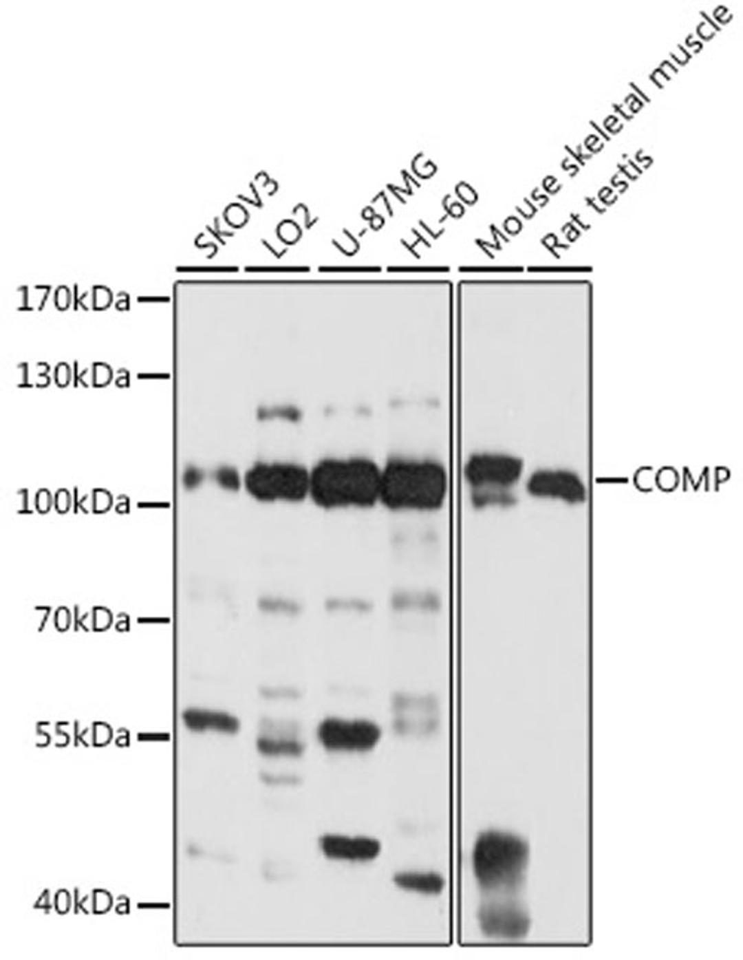 Western blot - COMP antibody (A13963)