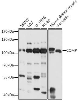 Western blot - COMP antibody (A13963)