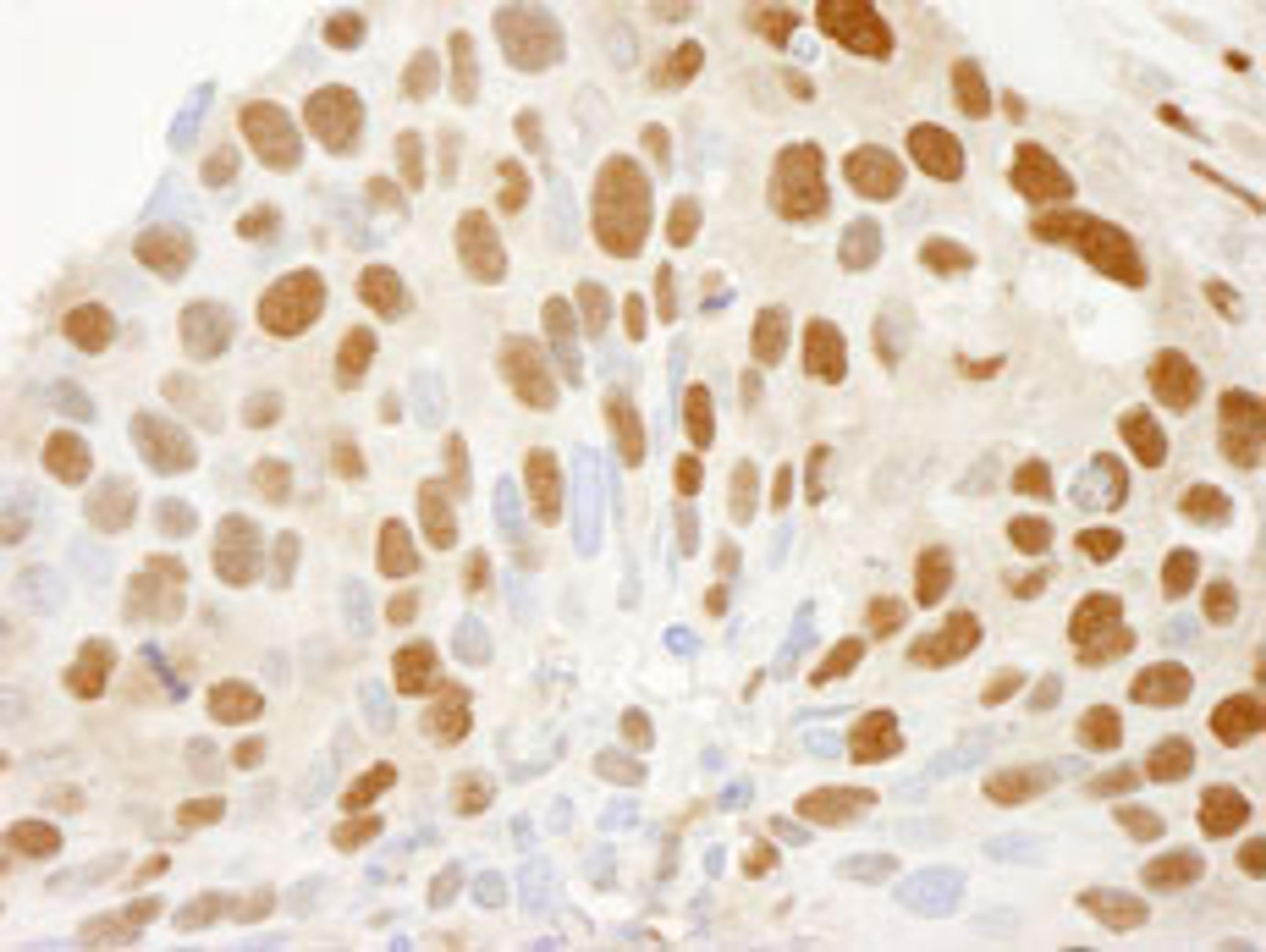 Detection of human CRM1 (Exportin 1) by immunohistochemistry.