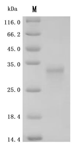 (Tris-Glycine gel) Discontinuous SDS-PAGE (reduced) with 5% enrichment gel and 15% separation gel.