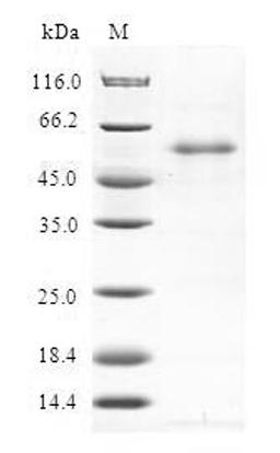 (Tris-Glycine gel) Discontinuous SDS-PAGE (reduced) with 5% enrichment gel and 15% separation gel.