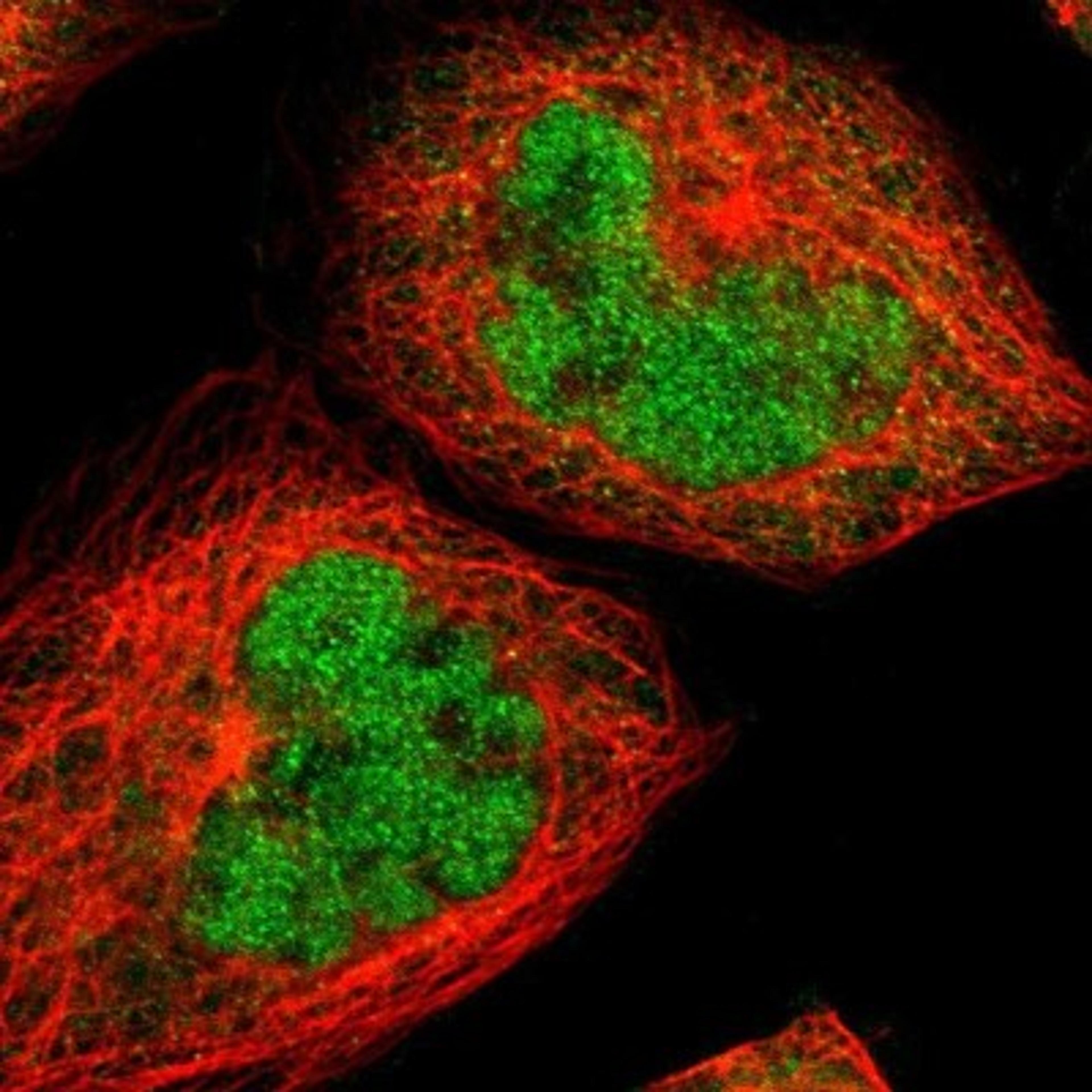 Immunocytochemistry/Immunofluorescence: MRAP2 Antibody [NBP1-88752] - Staining of human cell line A-431 shows positivity in nucleus but not nucleoli & cytoplasm.