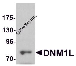 Western blot analysis of DNM1L in HeLa cell lysate with DNM1L antibody at 1 &#956;g/ml.